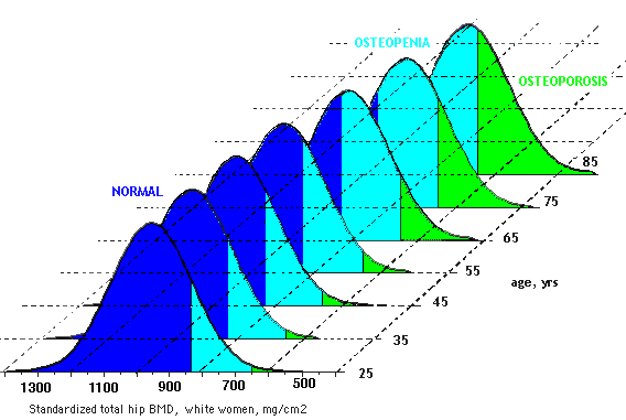 Betinget N-fordeling